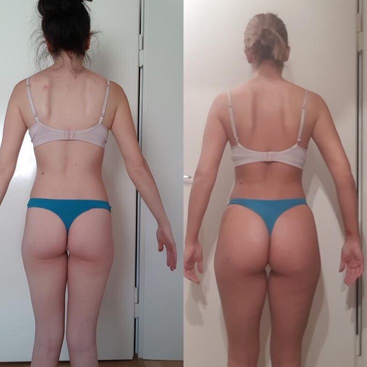 before and after weightloss